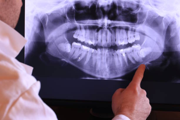 Best Emergency Treatment for Dental Infections or Abscesses in Nashua, IA